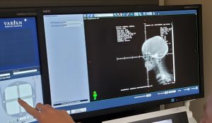 Radiation - Week One Done - targeting the eye